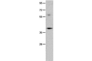 Western Blot analysis of Mouse brain tissue using OPCML Polyclonal Antibody at dilution of 1:400 (OPCML antibody)