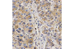 Immunohistochemistry (IHC) image for anti-VAMP (Vesicle-Associated Membrane Protein)-Associated Protein B and C (VAPB) antibody (ABIN1876551) (VAPB antibody)