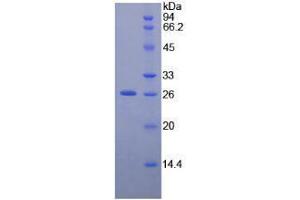 SDS-PAGE analysis of Human NEFM Protein. (NEFM Protein)