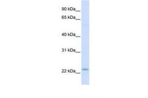 Receptor Accessory Protein 1 antibody  (C-Term)