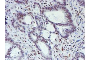 Image no. 5 for anti-WW Domain Containing Transcription Regulator 1 (WWTR1) antibody (ABIN1501763) (WWTR1 antibody)