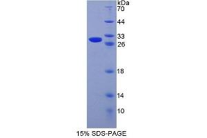 SDS-PAGE (SDS) image for Cysteine-Rich Secretory Protein 1 (CRISP1) (AA 20-244) protein (His tag) (ABIN4989225)