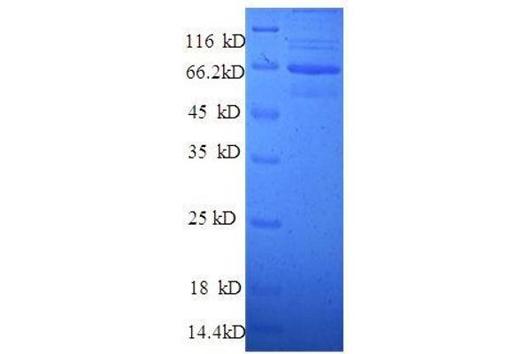 TLN1 Protein (AA 92-399, partial) (GST tag)