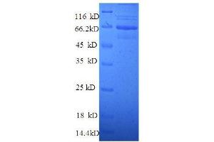Talin 1 (TLN1) (AA 92-399), (partial) protein (GST tag) (TLN1 Protein (AA 92-399, partial) (GST tag))