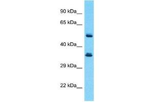 Host:  Rabbit  Target Name:  SERPINB3  Sample Type:  Thymus Tumor lysates  Antibody Dilution:  1. (SERPINB3 antibody  (Middle Region))