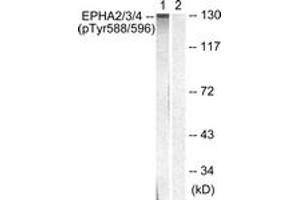 Western blot analysis of extracts from HepG2 cells, using EPHA2/3 (Phospho-Tyr588/596) Antibody. (EPHA2/3 antibody  (pTyr588))