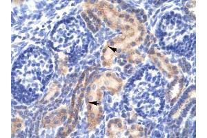 PCK1 antibody was used for immunohistochemistry at a concentration of 4-8 ug/ml to stain Epithelial cells of renal tubule (arrows) in Human Kidney. (PCK1 antibody  (Soluble))