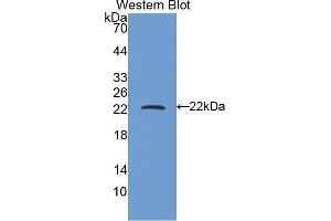 Western blot analysis of the recombinant protein. (FTH1 antibody  (AA 1-171))
