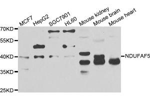 Western blot analysis of extracts of various cell lines, using NDUFAF5 antibody. (C20orf7 antibody)