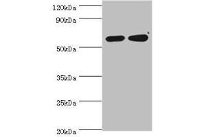 Western blot All lanes: P4HA2 antibody at 6 μg/mL Lane 1: HepG2 whole cell lysate Lane 2: 293T whole cell lysate Secondary Goat polyclonal to rabbit IgG at 1/10000 dilution Predicted band size: 61 kDa Observed band size: 61 kDa (P4HA2 antibody  (AA 236-535))