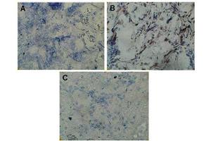 Image no. 1 for anti-Twist Homolog 1 (Drosophila) (TWIST1) (N-Term) antibody (ABIN347415) (TWIST1 antibody  (N-Term))