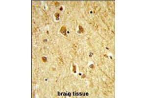 Formalin-fixed and paraffin-embedded human brain tissue reacted with ADAMTS18 Antibody , which was peroxidase-conjugated to the secondary antibody, followed by DAB staining. (ADAMTS18 antibody  (C-Term))