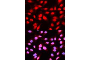 Immunofluorescence analysis of U2OS cells using U2AF2 antibody. (U2AF2 antibody)
