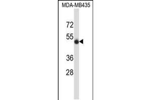 Western blot analysis in MDA-MB435 cell line lysates (35ug/lane). (CD43 antibody  (N-Term))