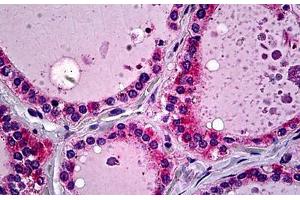 Human Thyroid: Formalin-Fixed, Paraffin-Embedded (FFPE) (SFTPD antibody  (AA 21-376))