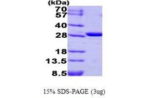 SDS-PAGE (SDS) image for Carbonic Anhydrase III (CA3) (AA 1-260) protein (ABIN666960) (CA3 Protein (AA 1-260))