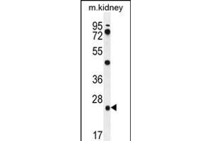 PGPEP1 Antibody (N-term) (ABIN655631 and ABIN2845110) western blot analysis in mouse kidney tissue lysates (35 μg/lane).