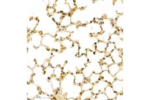 Immunohistochemistry of paraffin embedded mouse pneumonia using MNDA (ABIN7074709) at dilution of 1:2000 (400x lens) (MNDA antibody)