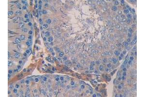 Used in DAB staining on fromalin fixed paraffin- embedded stomach tissue (ANGPTL2 antibody  (AA 47-207))