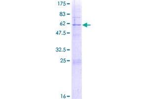 RPS4Y1 Protein (AA 1-263) (GST tag)