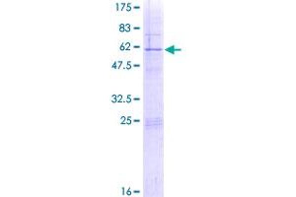 RPS4Y1 Protein (AA 1-263) (GST tag)