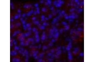 Immunofluorescence analysis of Rat lung tissue using GLUT-1 Polyclonal Antibody at dilution of 1:200. (GLUT1 antibody)