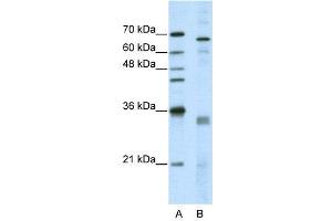 WB Suggested Anti-SFRS1  Antibody Titration: 5. (SRSF1 antibody  (Middle Region))
