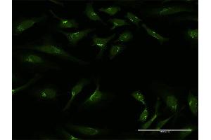 Immunofluorescence of purified MaxPab antibody to GOLGA1 on HeLa cell. (GOLGA1 antibody  (AA 1-767))
