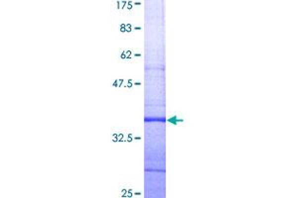 KCNH2 Protein (AA 684-773) (GST tag)