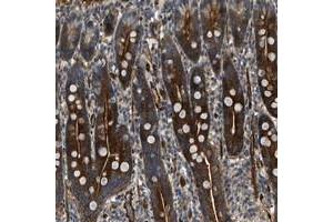 Immunohistochemical staining of human duodenum with KIAA1305 polyclonal antibody  shows strong cytoplasmic and membranous positivity in glandular cells at 1:50-1:200 dilution. (NYNRIN antibody)