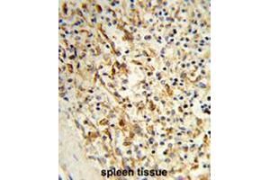 Formalin-fixed and paraffin-embedded human spleen tissue reacted with PCAT1 Antibody (C-term), which was peroxidase-conjugated to the secondary antibody, followed by DAB staining. (LPCAT1 antibody  (C-Term))