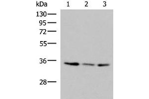 Western blot analysis of HepG2 HL60 cell Human fetal liver tissue lysates using ISY1-RAB43 Polyclonal Antibody at dilution of 1:1000 (ISY1-RAB43 Readthrough (ISY1-RAB43) antibody)