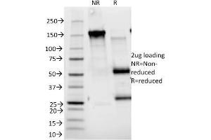 SDS-PAGE Analysis Purified CD25 Mouse Monoclonal Antibody (143-13). (CD25 antibody)