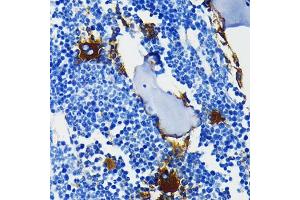 Immunohistochemistry (IHC) image for anti-Integrin beta 3 (ITGB3) antibody (ABIN7267928)