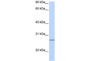 GRPEL2 antibody used at 1 ug/ml to detect target protein. (GRPEL2 antibody)