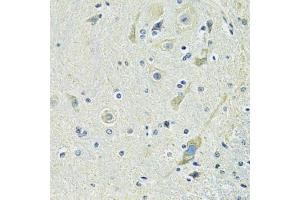 Immunohistochemistry of paraffin-embedded mouse spinal cord using SLC1A4 antibody (ABIN6292419) at dilution of 1:100 (40x lens).