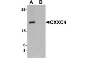 Western blot analysis of CXXC4 in human brain tissue lysate with CXXC4 antibody at 1 μg/ml in (A) the absence and (B) the presence of blocking peptide.