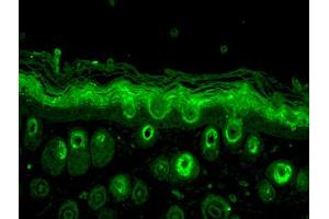Rab5, mouse backskin. (RAB5 antibody)