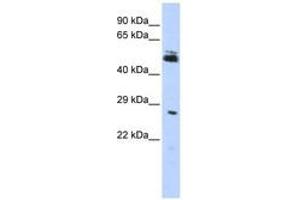 Image no. 1 for anti-Ring Finger Protein 212 (RNF212) (AA 72-121) antibody (ABIN6740828) (RNF212 antibody  (AA 72-121))