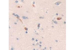 IHC-P analysis of Human Tissue, with DAB staining. (BIM antibody  (AA 2-120))
