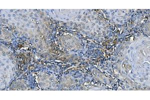 IHC analysis of GABARAP using anti-GABARAP antibody (ABIN7603159). (GABARAP antibody  (N-Term))