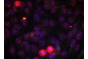 Immunofluorescence staining of methanol-fixed HeLa cells using ELK1 (phospho T417) polyclonal antibody . (ELK1 antibody  (pThr417))