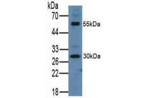 Figure. (ITLN1/Omentin antibody  (AA 31-253))