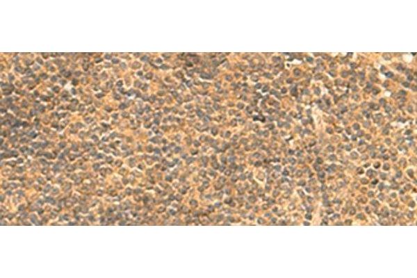 FAM186B antibody