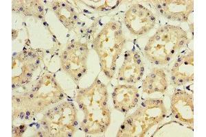 Immunohistochemistry of paraffin-embedded human kidney tissue using ABIN7141980 at dilution of 1:100 (IFNA1 antibody  (AA 24-189))