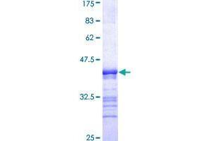 PEAK1 Protein (AA 1151-1250) (GST tag)