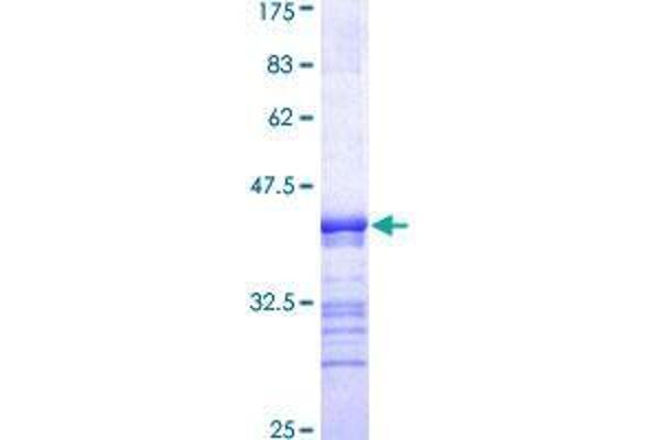 PEAK1 Protein (AA 1151-1250) (GST tag)