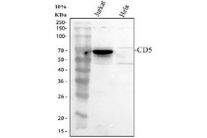 Western blot analysis of CD5 using anti-CD5 antibody (ABIN5693203). (CD5 antibody  (AA 25-495))