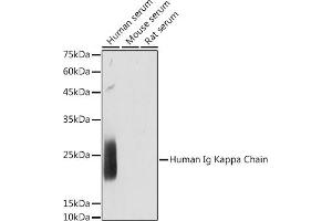 Western blot analysis of extracts of various cell lines, using Human Ig Kappa Chain antibody (ABIN7267846) at 1:1000 dilution. (IGKC antibody)