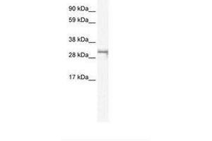 Image no. 1 for anti-Short Stature Homeobox 2 (SHOX2) (AA 180-229) antibody (ABIN6735956) (SHOX2 antibody  (AA 180-229))